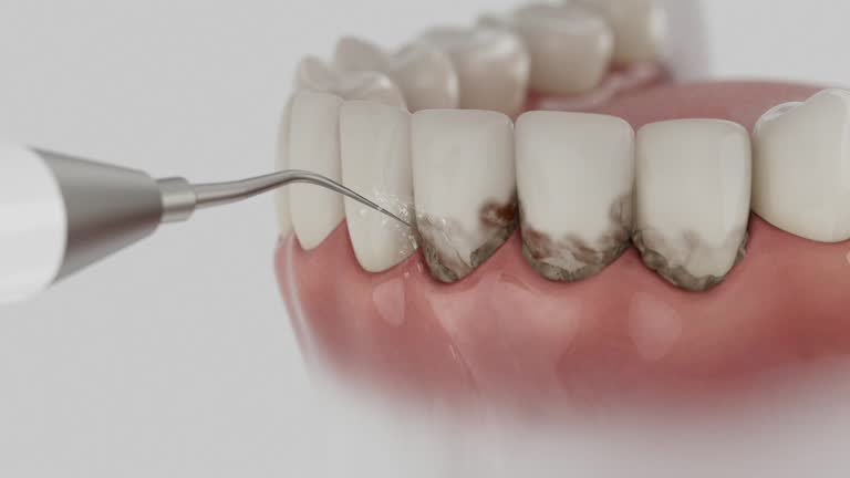 Reliable Dental Implants contractor in Hampton Manor, NY by Smile Center Dentistry